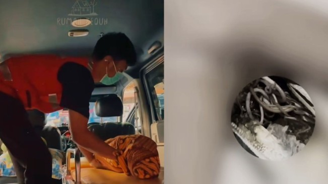 Anak di Sukabumi meninggal karena cacingan. [Istimewa]